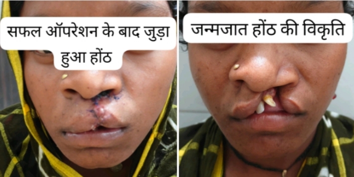 सफल सर्जरी से भीमे हेमला के चेहरे पर लौटी मुस्कान सफल सर्जरी से भीमे हेमला के चेहरे पर लौटी मुस्कान